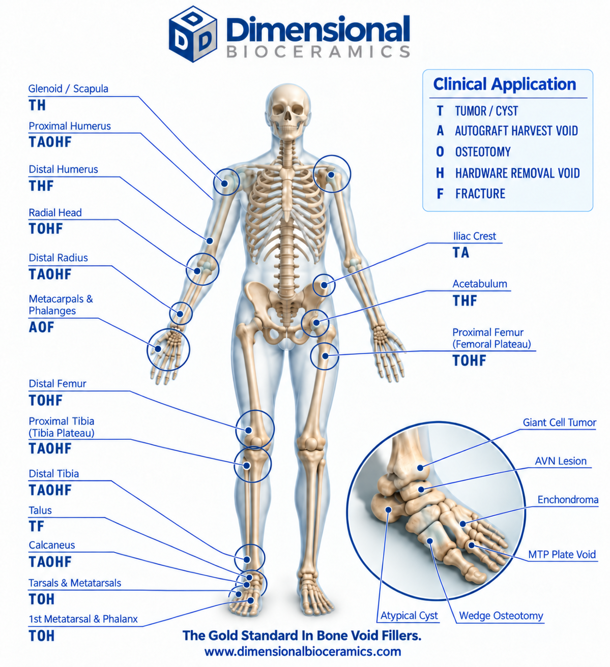Skeletal anatomy guide showing bone void contexts from the shoulder and upper extremity to the pelvis, lower extremity and foot; application key follows below
